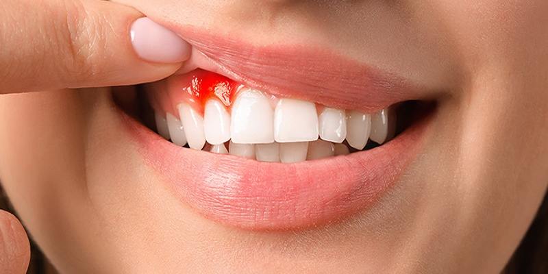 Thông điệp tích cực khi chiêm bao gãy răng hàm chảy máu