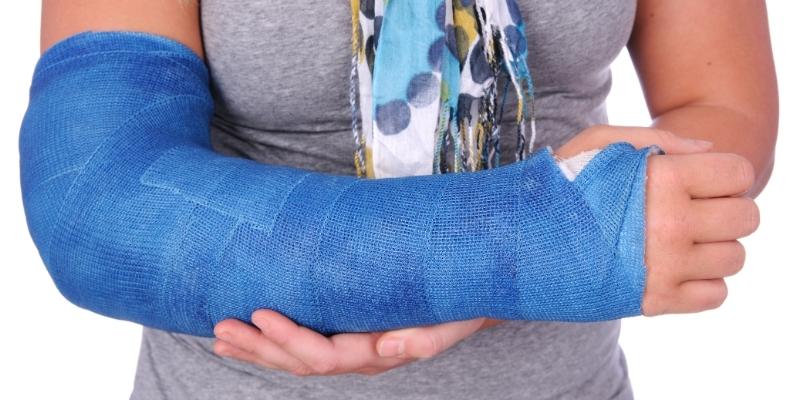 Nằm mơ thấy gãy tay có thể mang nhiều điềm báo